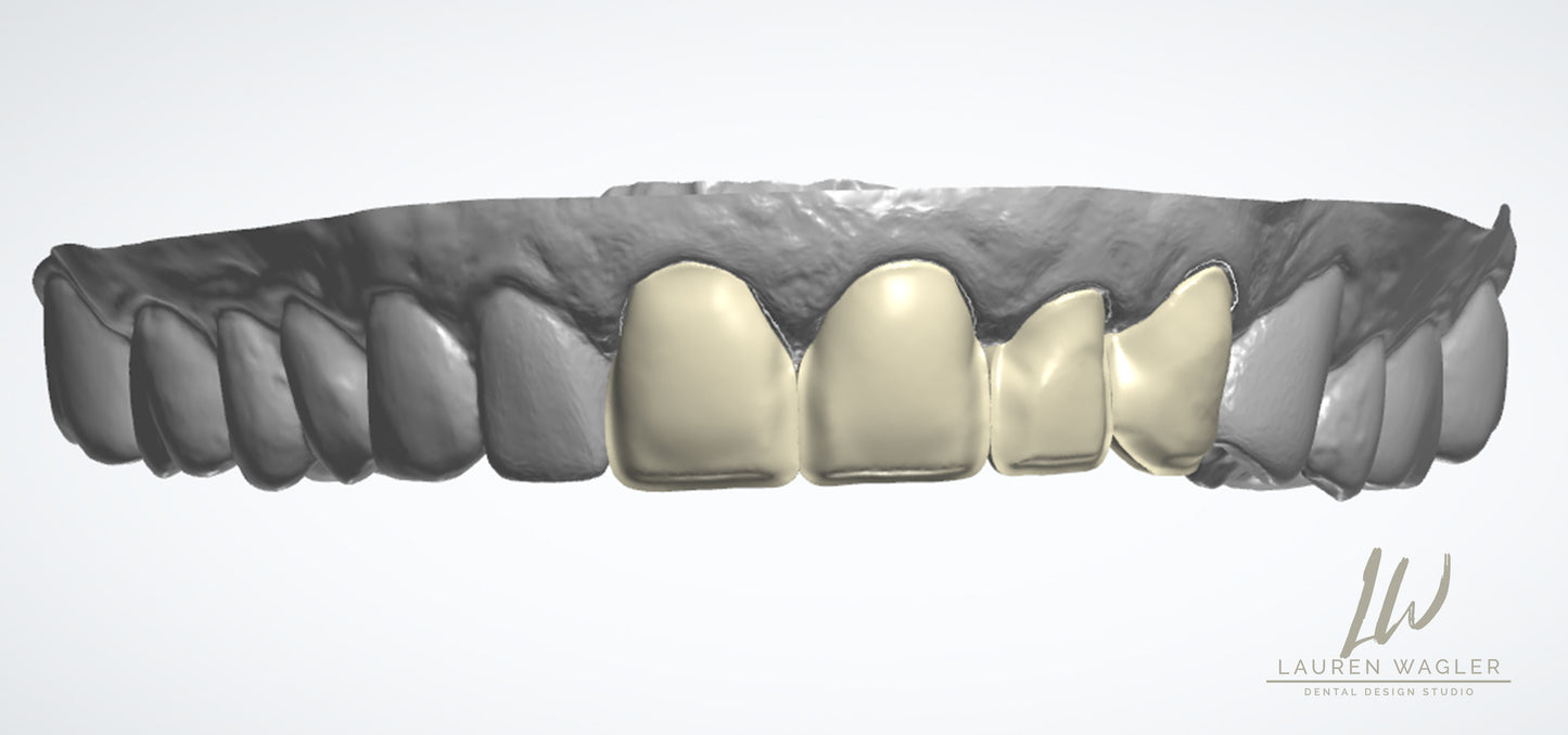 Layered Emax Digital Design